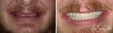 new before and after4 480x142