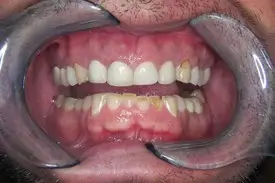 rehabilitation before 1