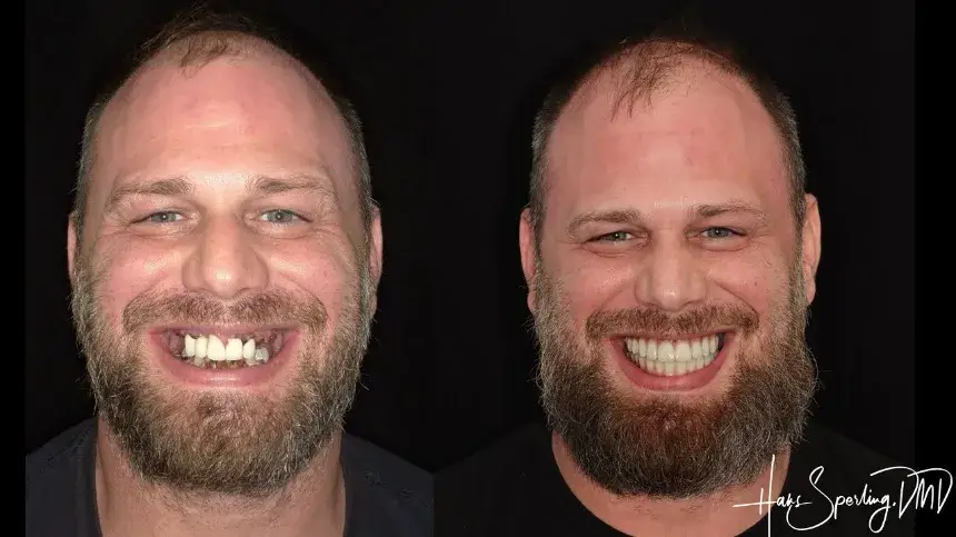 dentalcenter before&after1 (1)