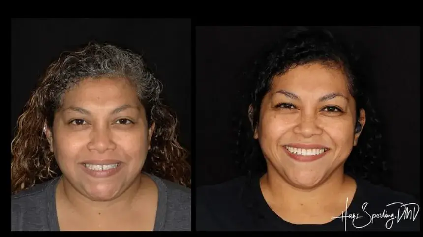 dentalcenter before&after2 (1)