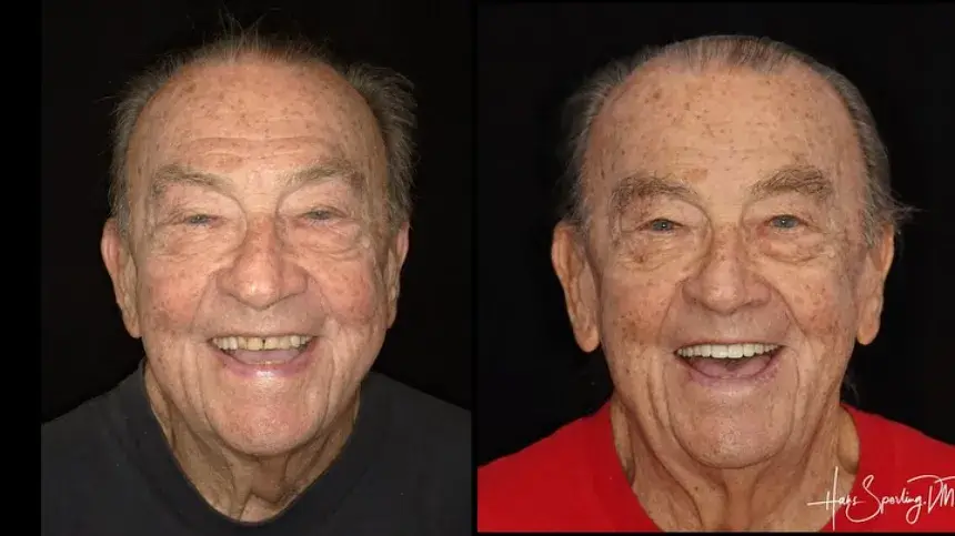 dentalcenter before&after3 (1)