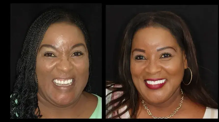 dentalcenter before&after5 (1)