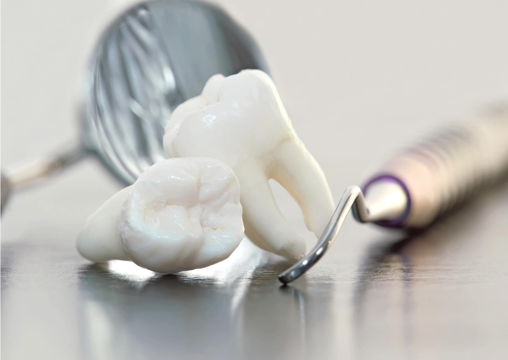 Extracted wisdom teeth beside dental instruments, illustrating a stage of wisdom tooth development and how long a wisdom tooth takes to come in once it starts.
