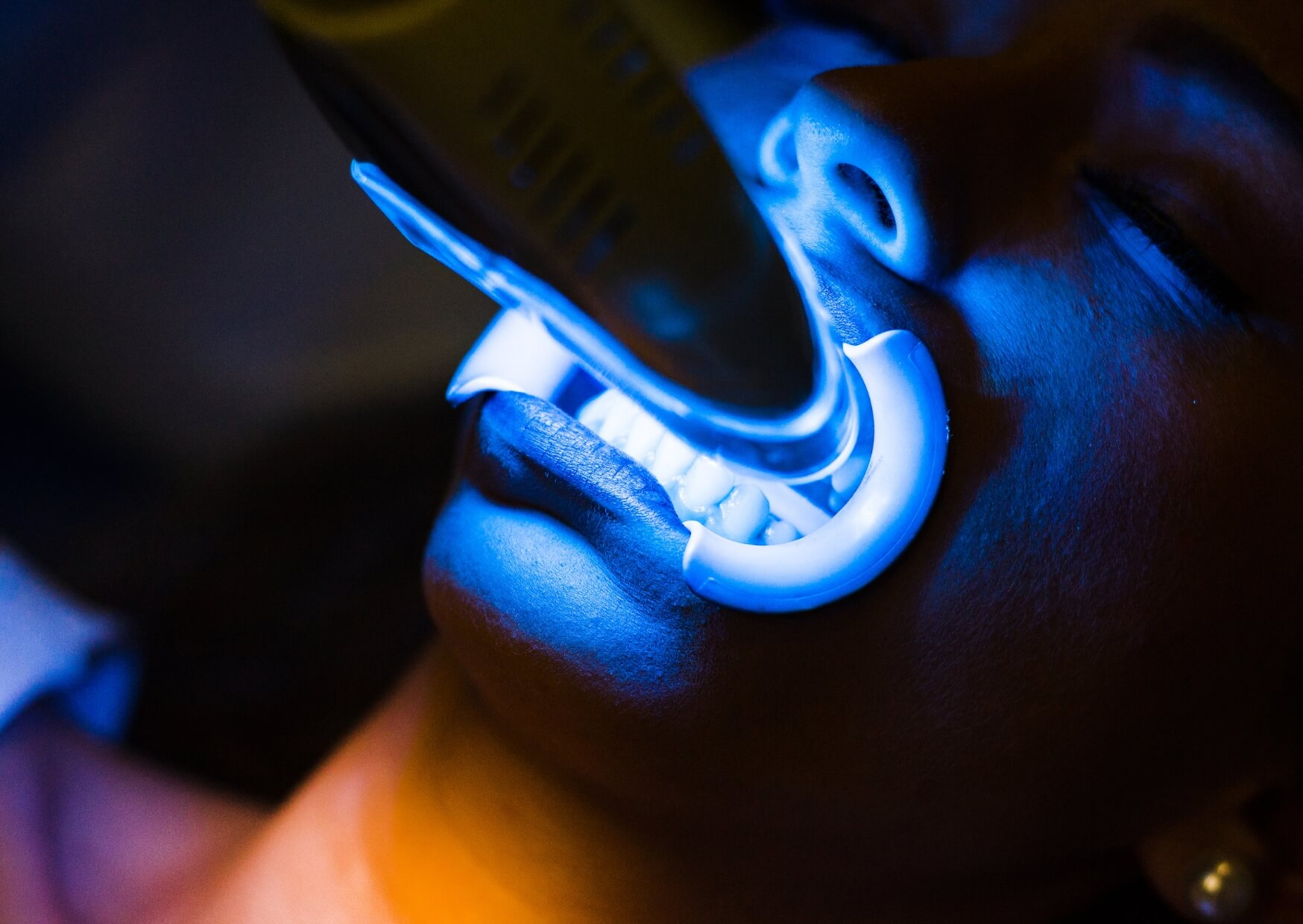 Patient wearing an LED whitening tray during an in-office procedure, highlighting a professional teeth whitening option for brighter teeth.